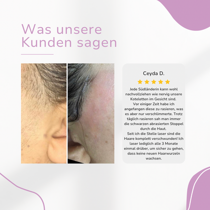 Ylvis NOVALABS Hair Remover I Die führende Laser-Haarentfernung für Zuhause