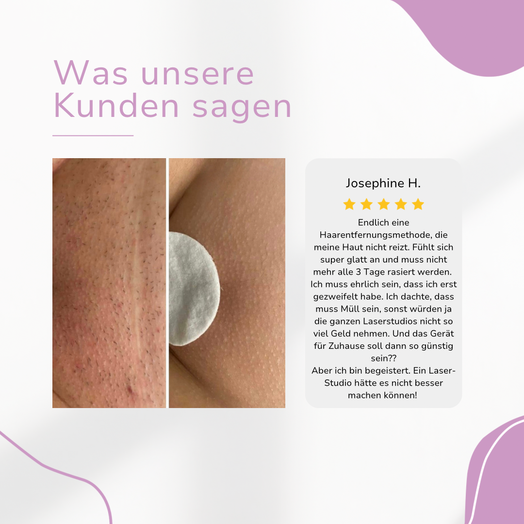 Ylvis NOVALABS Hair Remover I Die führende Laser-Haarentfernung für Zuhause