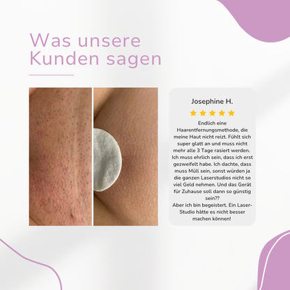 Ylvis NOVALABS Hair Remover I Die führende Laser-Haarentfernung für Zuhause