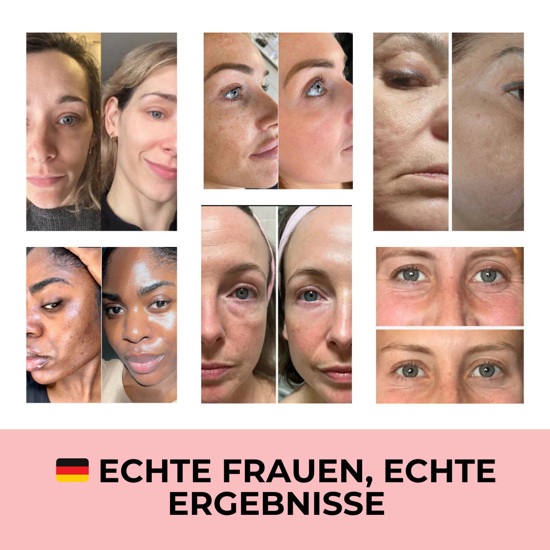 Professionell wiederaufladbarer Microneedling Dermapen