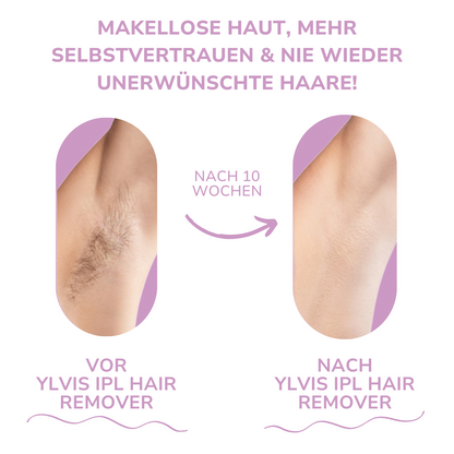 Ylvis NOVALABS Hair Remover I Die führende Laser-Haarentfernung für Zuhause